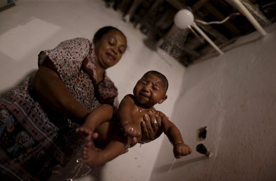 „Reuters“/„Scanpix“ nuotr./Brazilijoje dėl Zika viruso mikrocefalija sergantis kūdikis